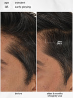 FutureIQ™ biomimetic hair longevity serum