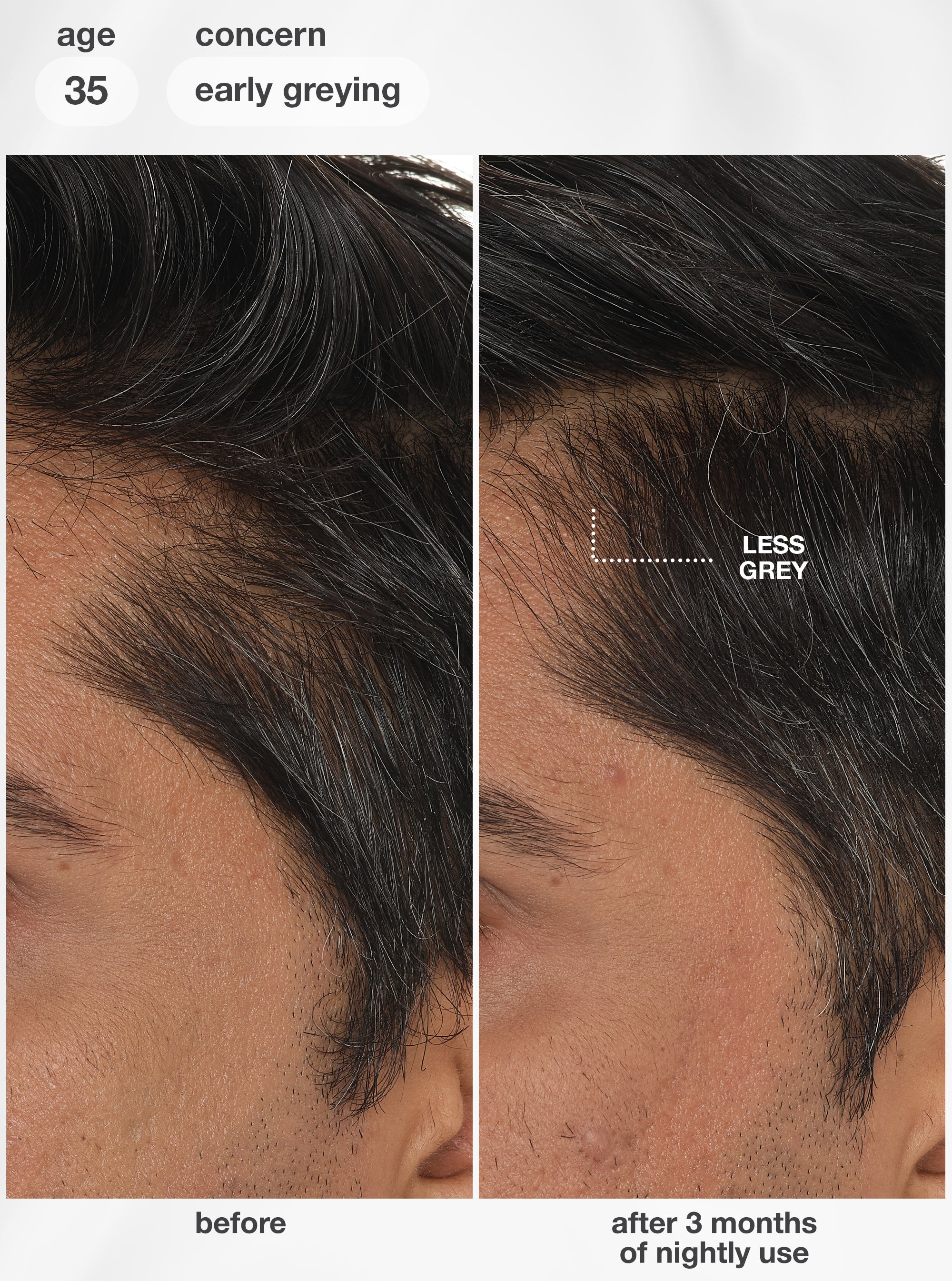 FutureIQ™ biomimetic hair longevity serum