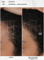 FutureIQ™ biomimetic hair longevity serum