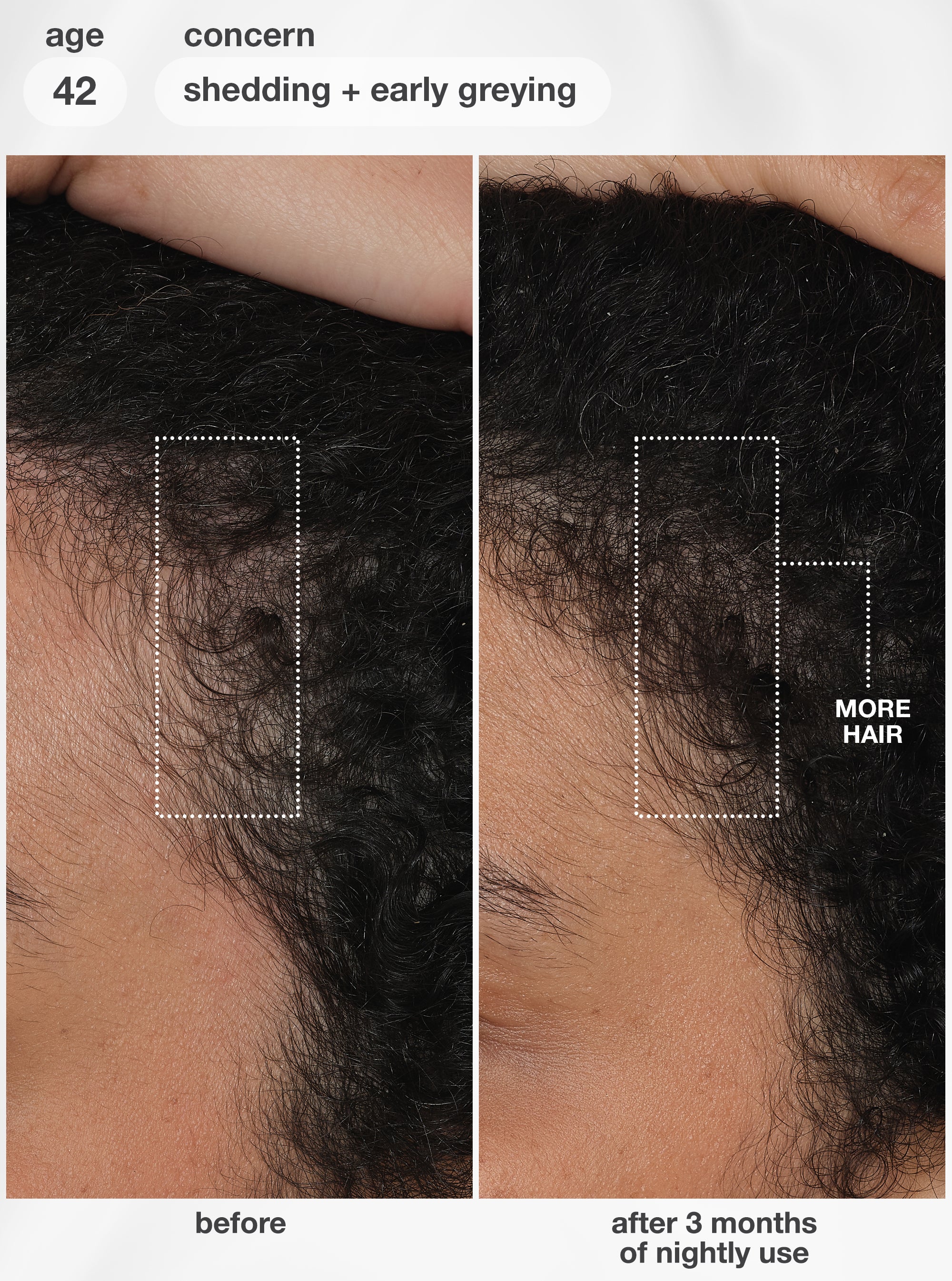 FutureIQ™ biomimetic hair longevity serum