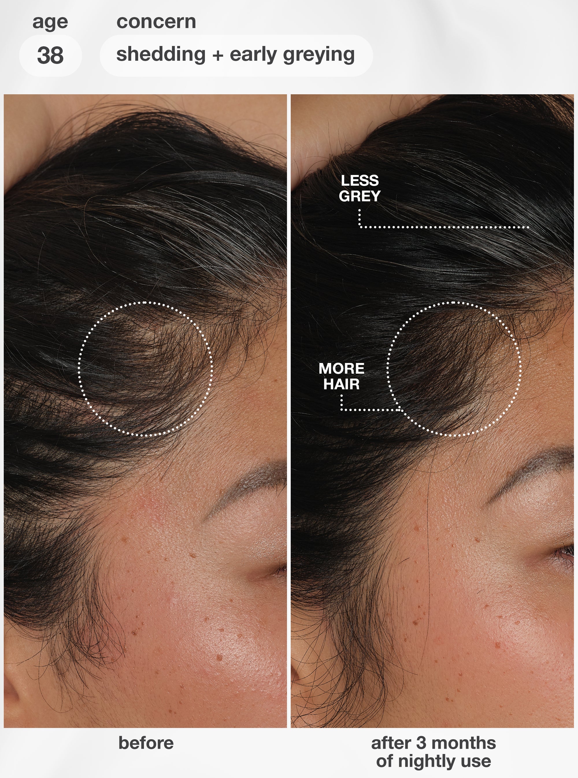 FutureIQ™ biomimetic hair longevity serum