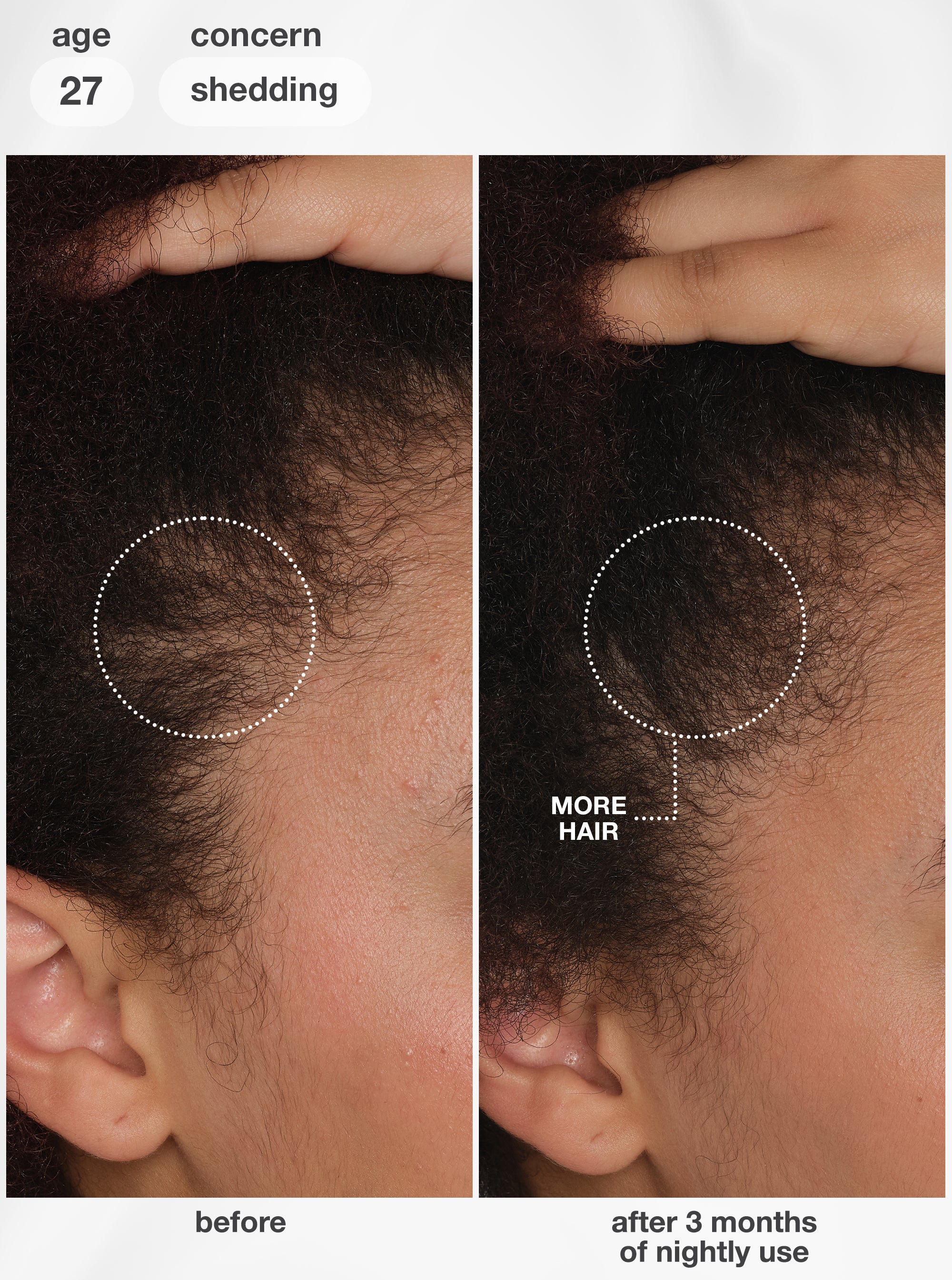FutureIQ™ biomimetic hair longevity serum