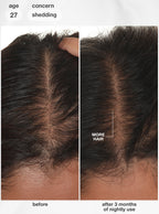FutureIQ™ biomimetic hair longevity serum