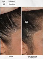 FutureIQ™ biomimetic hair longevity serum