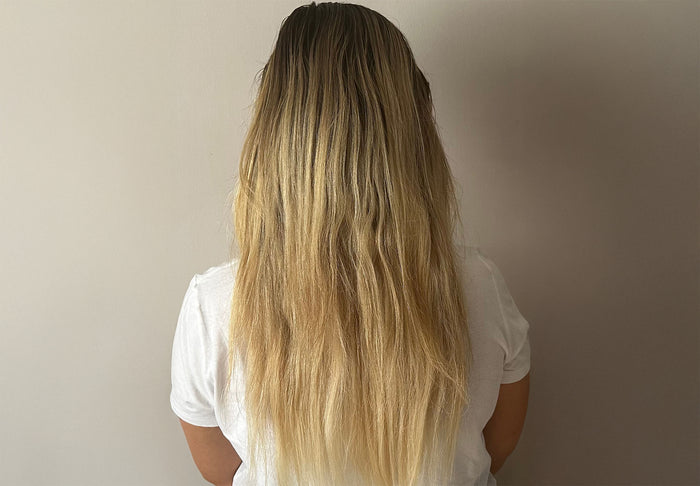 Postpartum hair shedding and regrowth